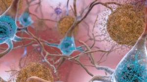 They Discover the Origin of 30% of Alzheimer's Amyloid Plaques